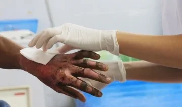 Mujer incendia a su companero tras anos de abuso y.webp