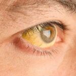 Se activa un plan especial de vigilancia por casos de