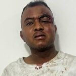 Ante la Fiscalia distrito reitera acusacion contra individuo que agredio