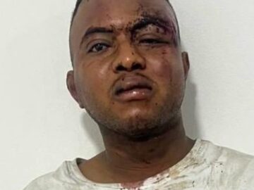 Ante la Fiscalia distrito reitera acusacion contra individuo que agredio