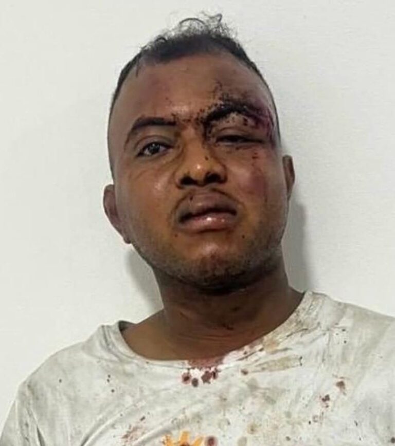 Ante la Fiscalia distrito reitera acusacion contra individuo que agredio