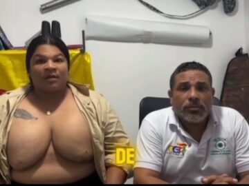 Denuncio al cirujano plastico Gabriel Monterrosa por dejarla con deformidades