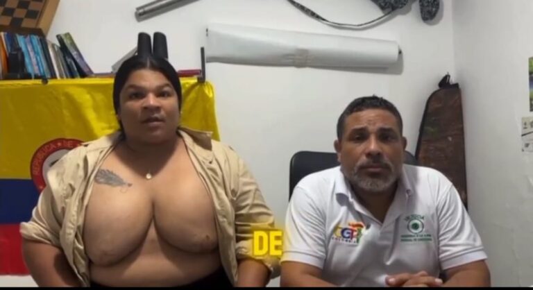 Denuncio al cirujano plastico Gabriel Monterrosa por dejarla con deformidades