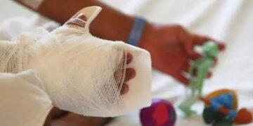 Cuatro heridos por polvora balance de la Noche de Velitas