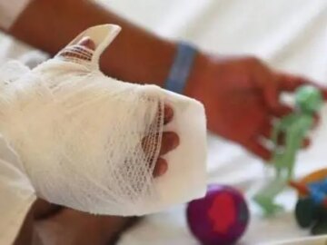 Cuatro heridos por polvora balance de la Noche de Velitas