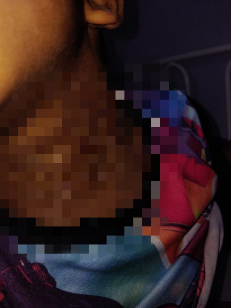 Denuncian caso de tortura a un nino de cuatro anos