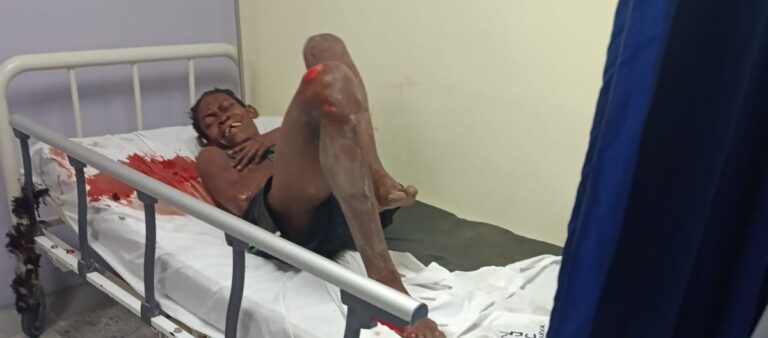 Ataque de machete de El Comanche a su madre en