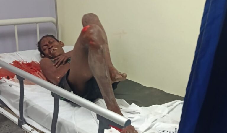 Ataque de machete de “El Comanche” a su madre en Villanueva, Bolívar.